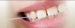 歯のすき間、前歯のスキッ歯